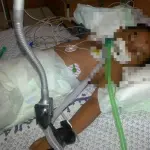 Bimbo rifiuta di fare i compiti: il padre lo percuote con un tubo